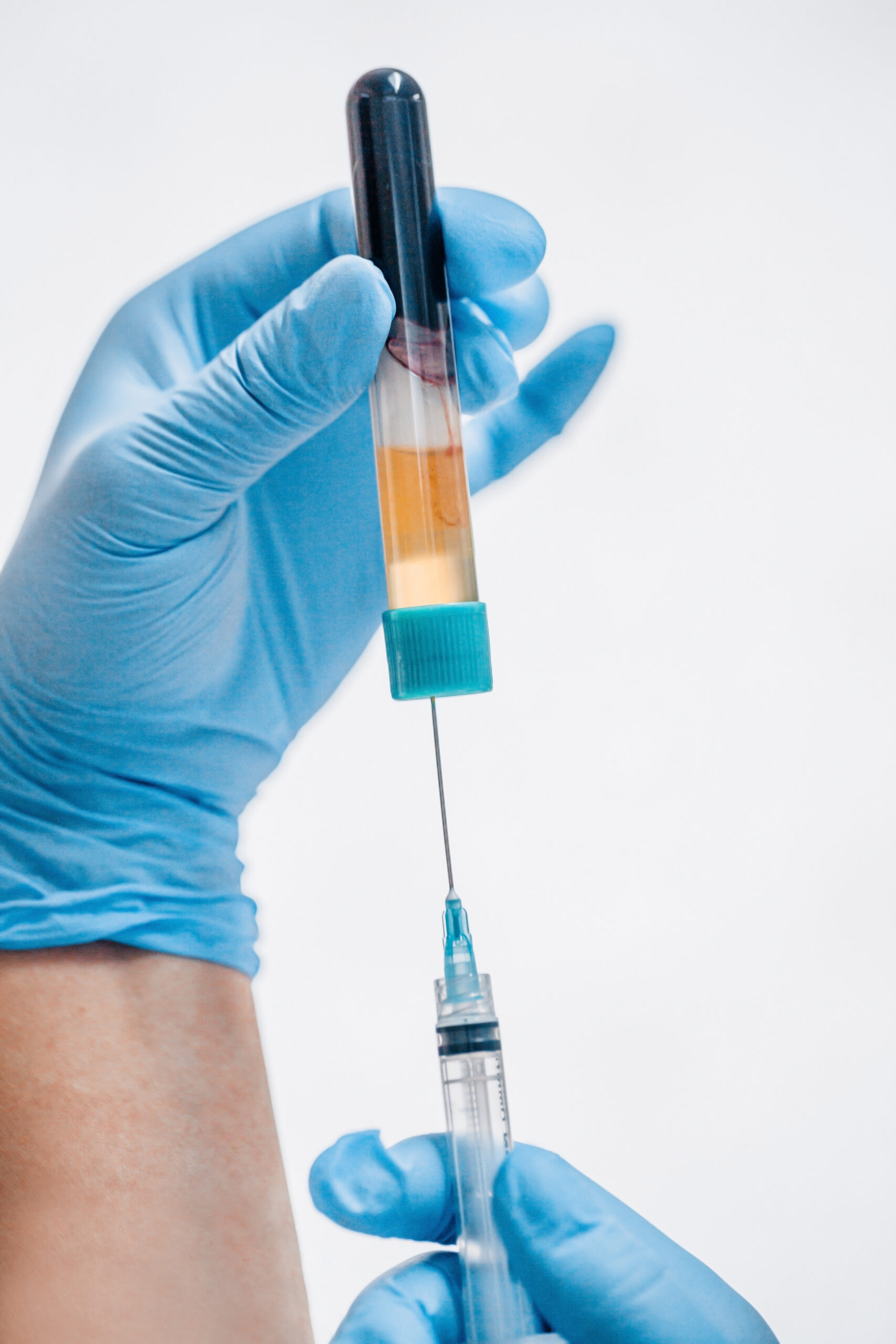 Platelet-Rich Plasma (PRP) Injections at High Caliber Chiropractic